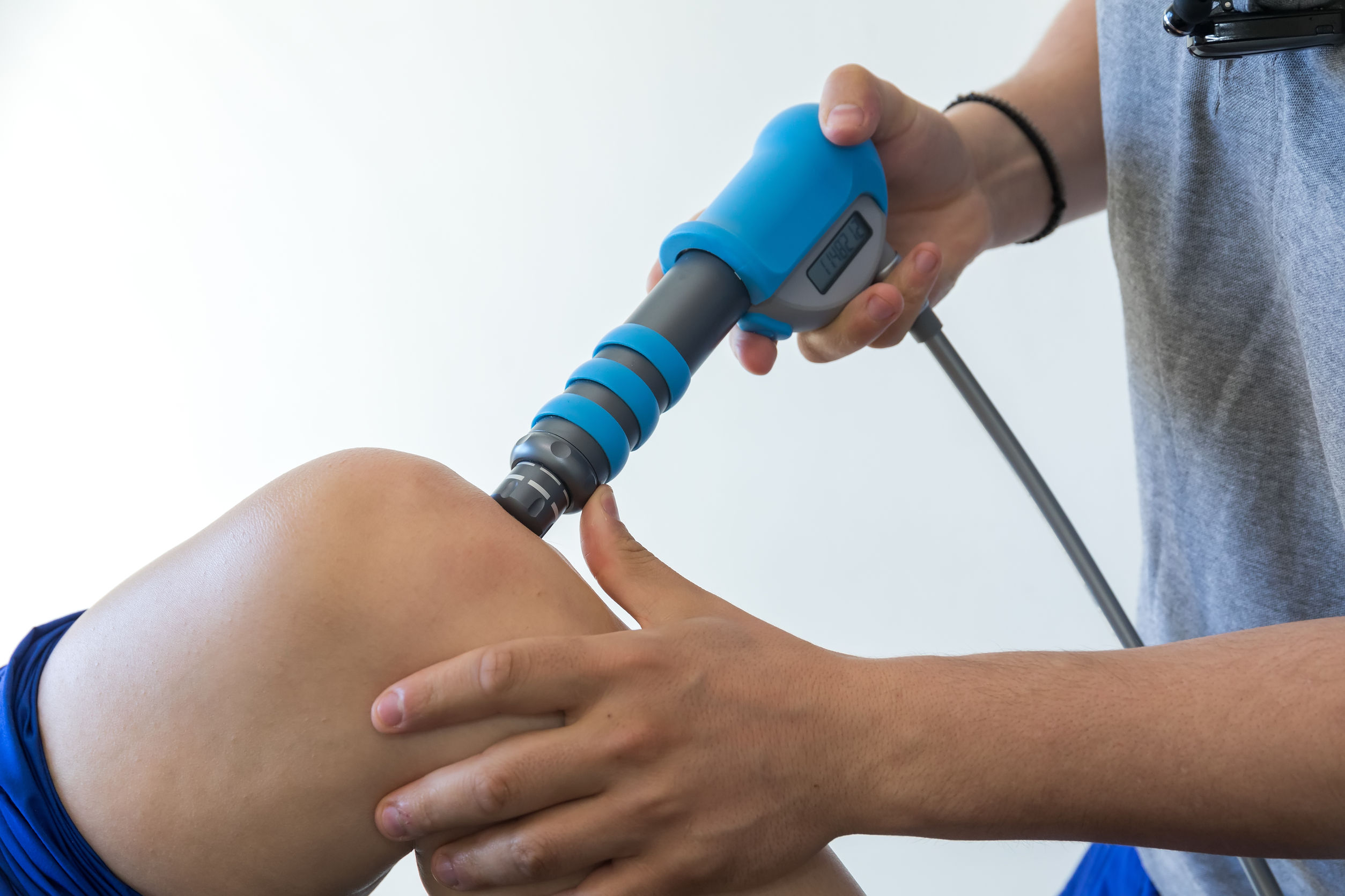Go to Extracorporeal Shockwave Therapy: An Introduction